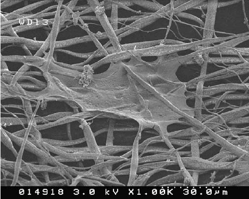 Nanofibre Scaffolds